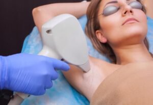 Laser Hair Removal in Nagpur at Trichoderm Centre