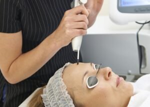 Q-Switched Laser for Pigmentation at Trichoderm Centre Nagpur