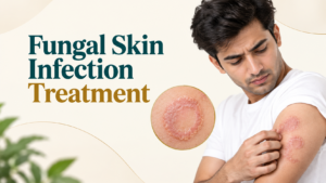 Fungal skin infection treatment in Nagpur at Trichoderm Centre