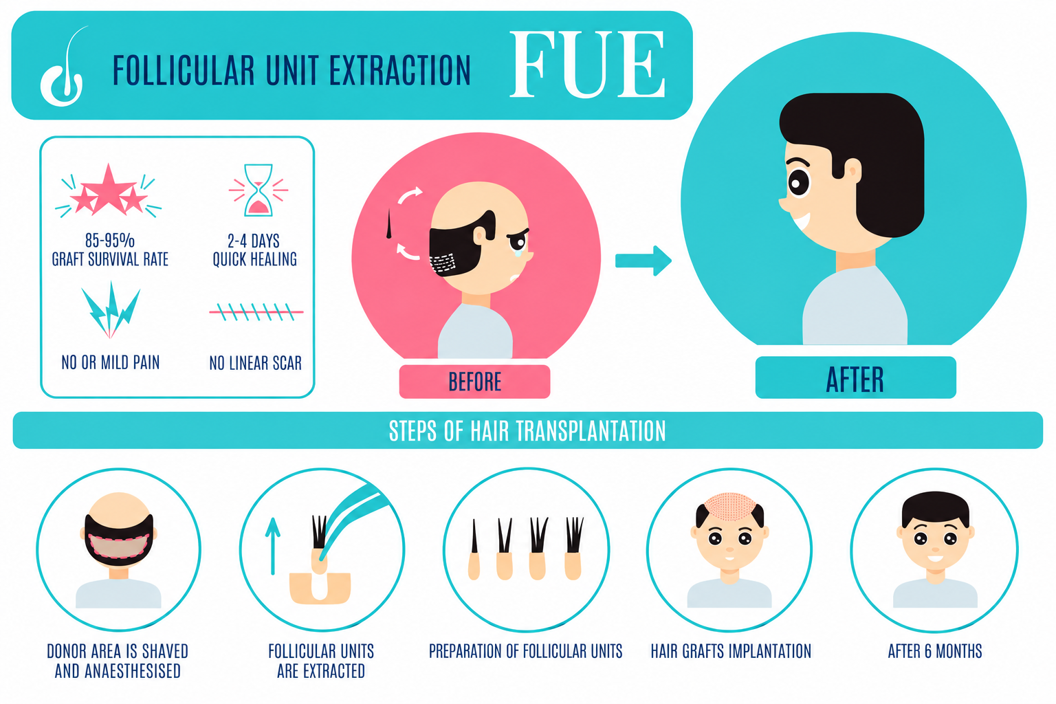 FUE Hair Transplantation Infographic - Trichoderm Centre Hair & Skin Clinic
