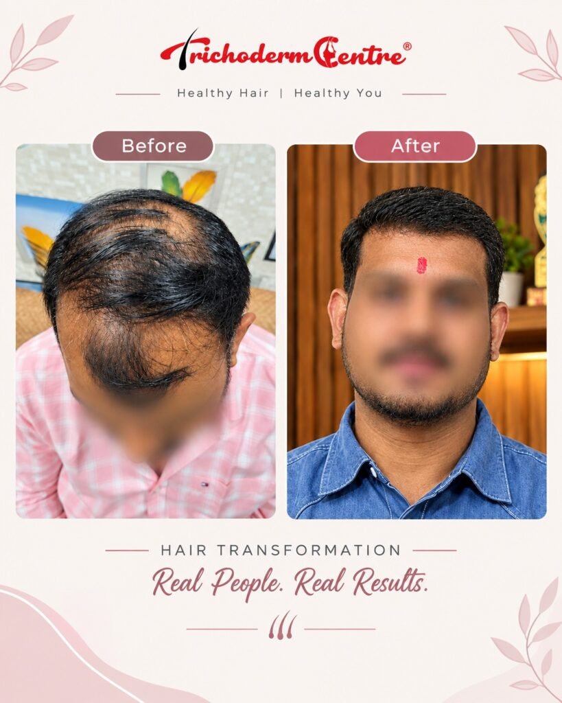 WhatsApp Image 2026 09 29 at 4.56.22 PM - Trichoderm Centre Hair & Skin Clinic
